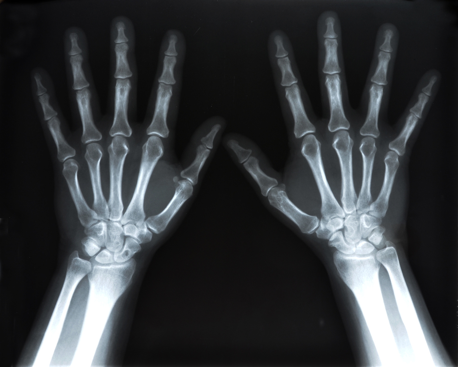 Printable Xray Templates Printable Free